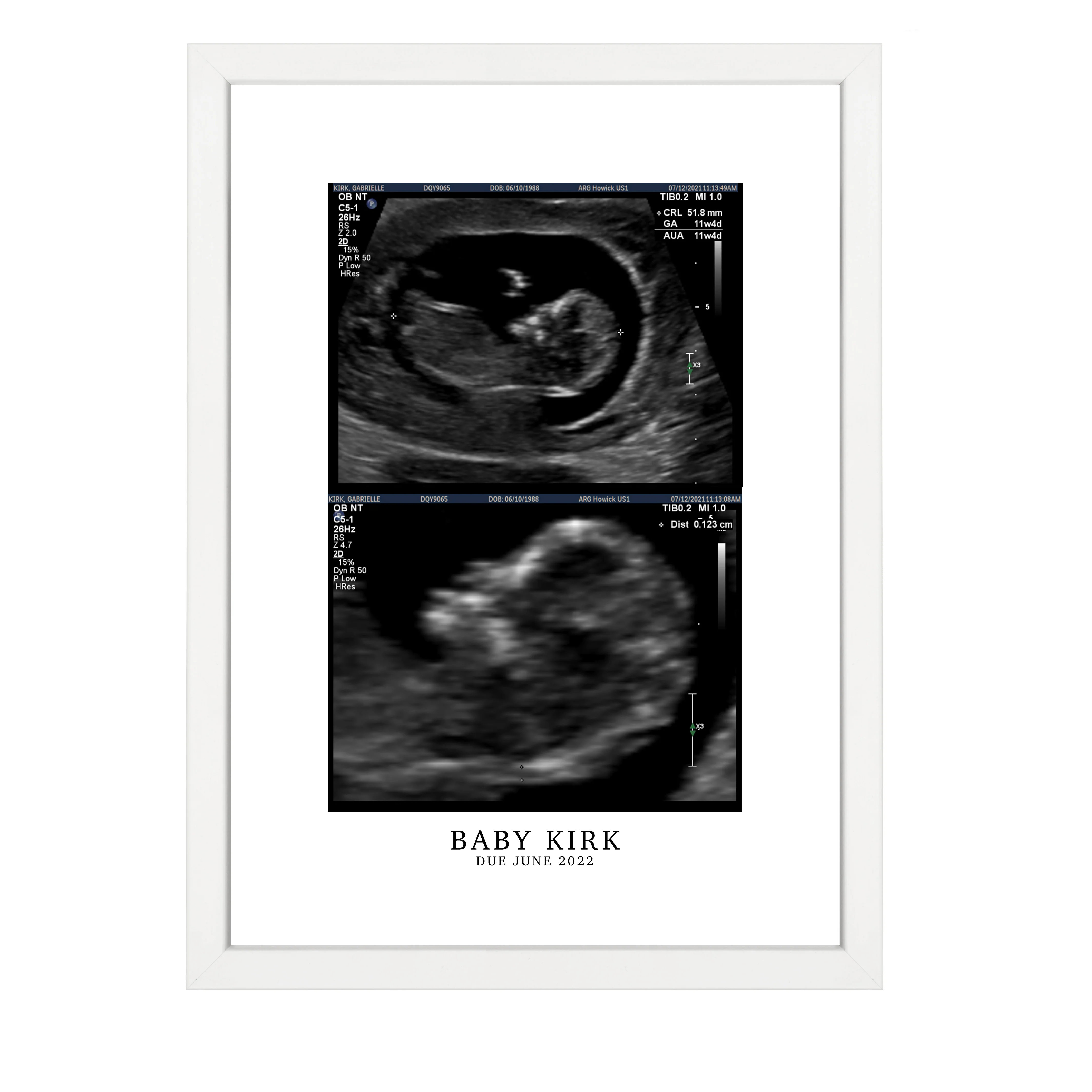 CUSTOM BIRTH ANNOUNCEMENT PRINT