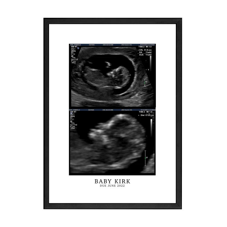 CUSTOM BIRTH ANNOUNCEMENT PRINT - Image 10