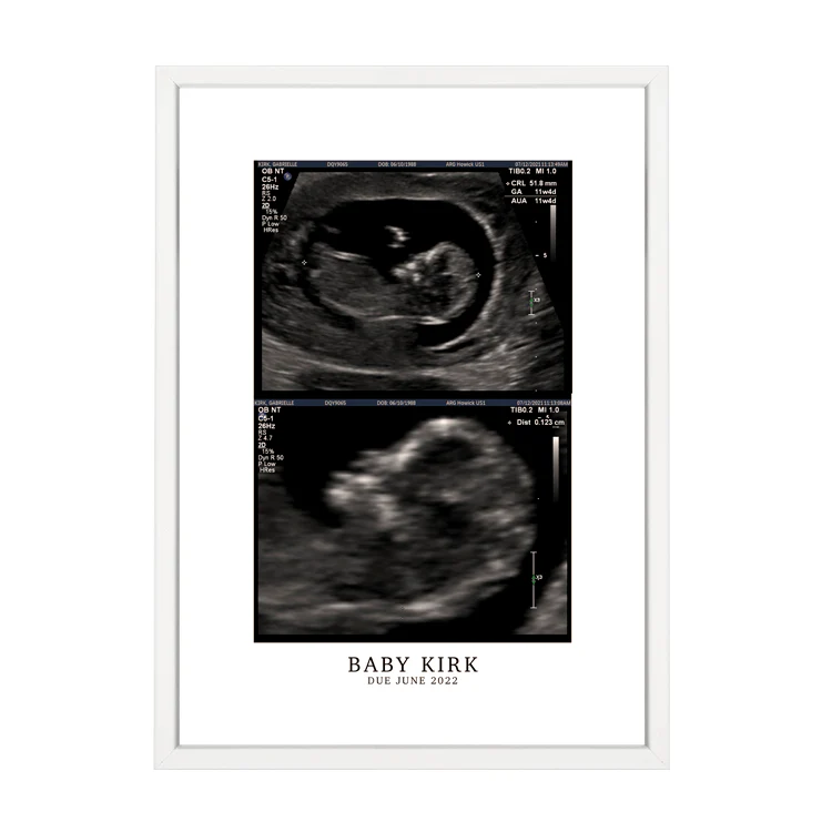 CUSTOM BIRTH ANNOUNCEMENT PRINT - Image 11