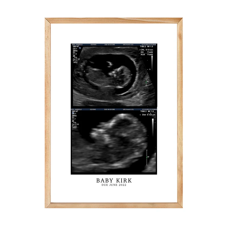 CUSTOM BIRTH ANNOUNCEMENT PRINT - Image 12