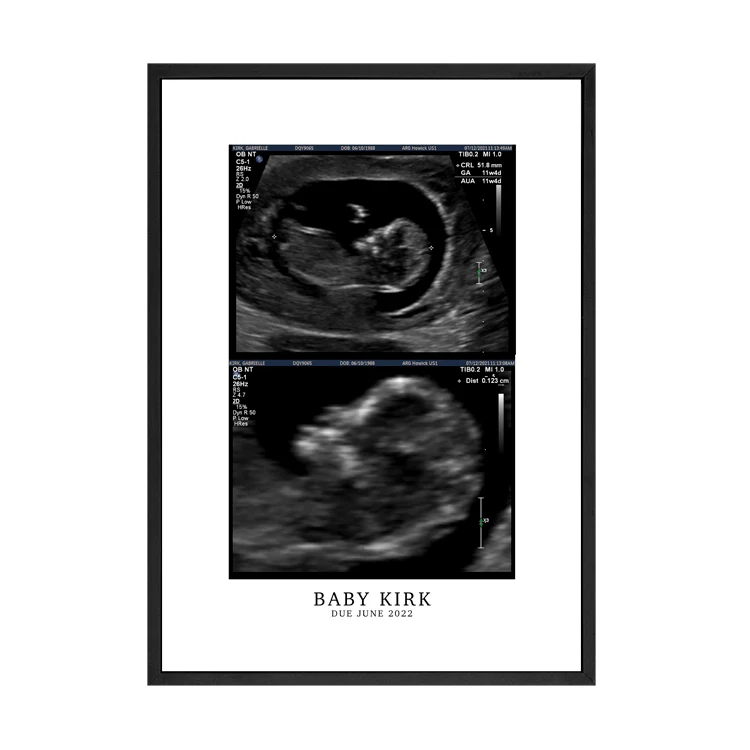 CUSTOM BIRTH ANNOUNCEMENT PRINT - Image 13