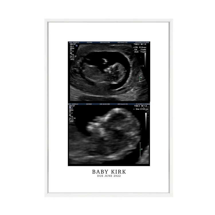 CUSTOM BIRTH ANNOUNCEMENT PRINT - Image 14