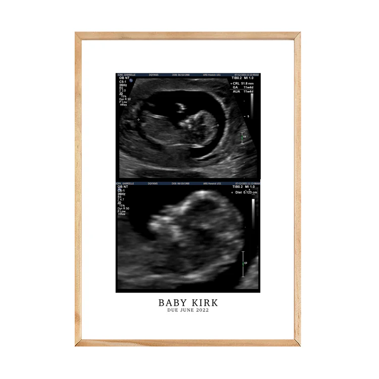 CUSTOM BIRTH ANNOUNCEMENT PRINT - Image 15
