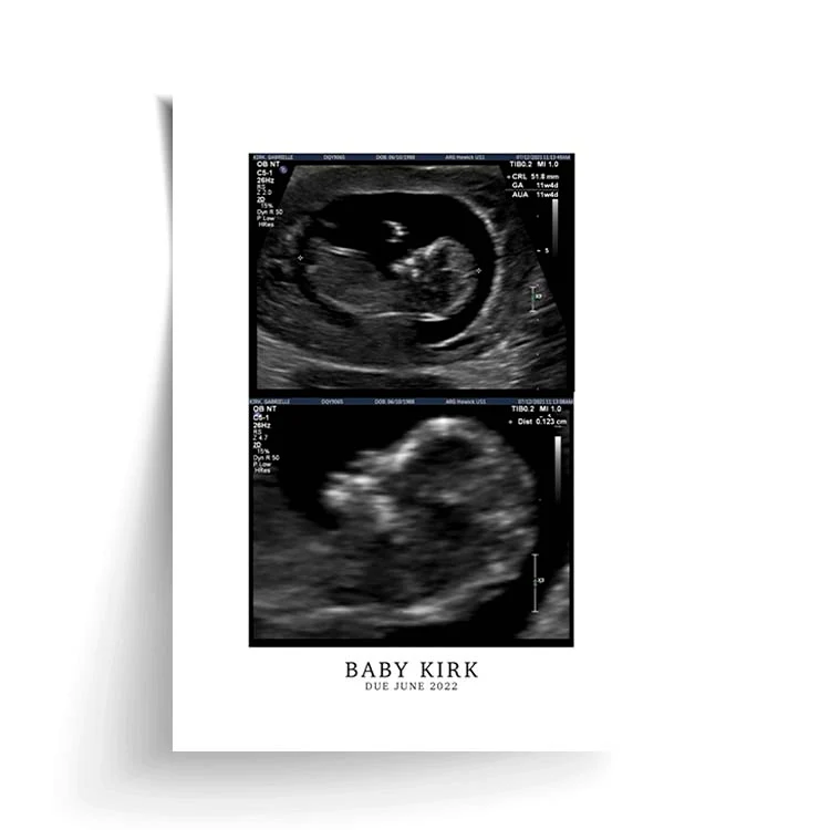 CUSTOM BIRTH ANNOUNCEMENT PRINT - Image 16