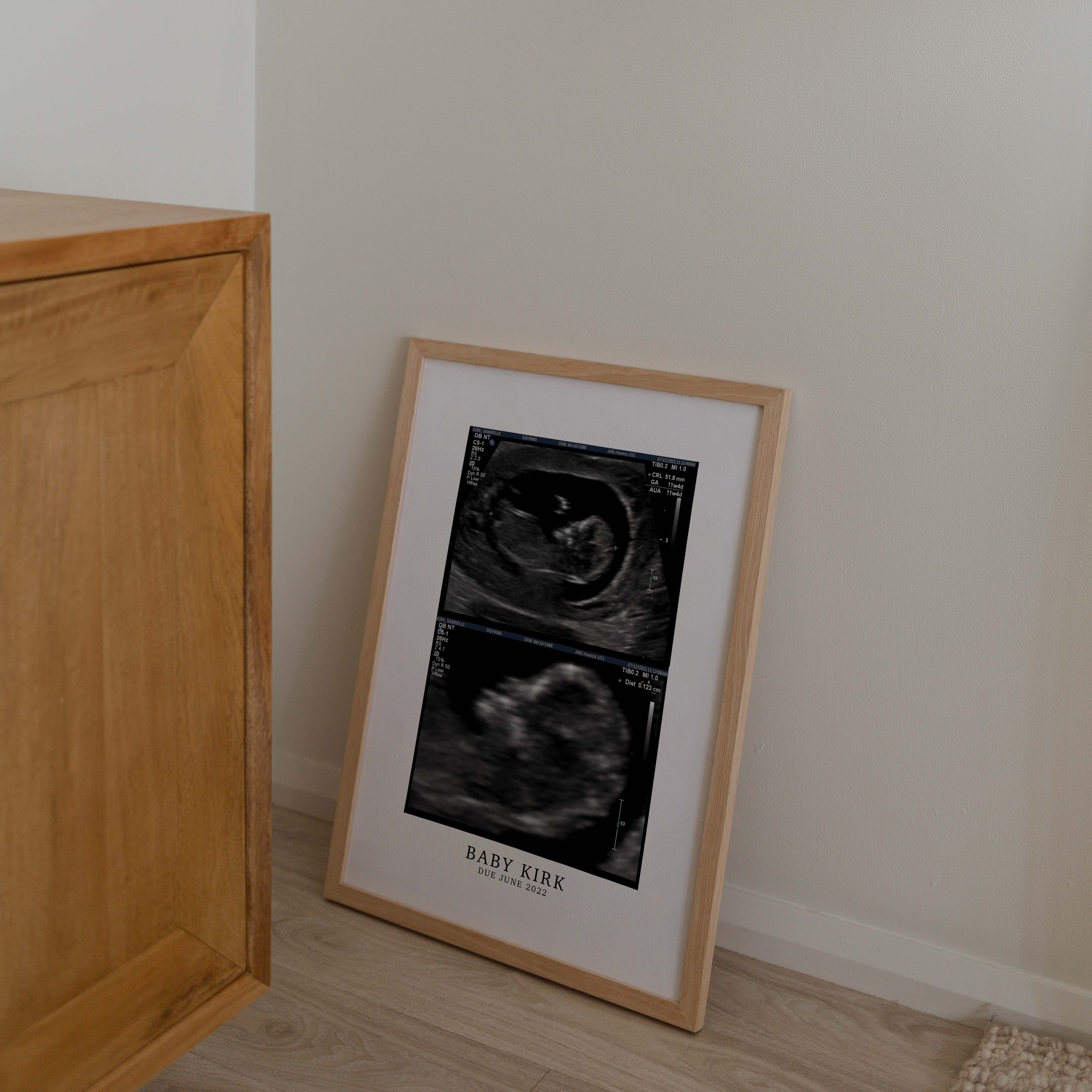 CUSTOM BIRTH ANNOUNCEMENT PRINT - Image 2