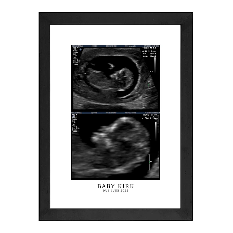 CUSTOM BIRTH ANNOUNCEMENT PRINT - Image 5