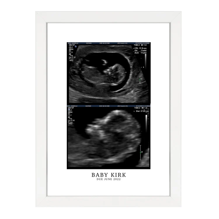 CUSTOM BIRTH ANNOUNCEMENT PRINT - Image 6