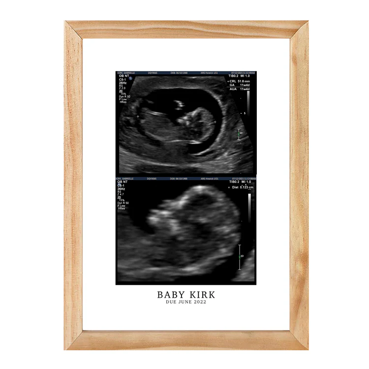 CUSTOM BIRTH ANNOUNCEMENT PRINT - Image 7