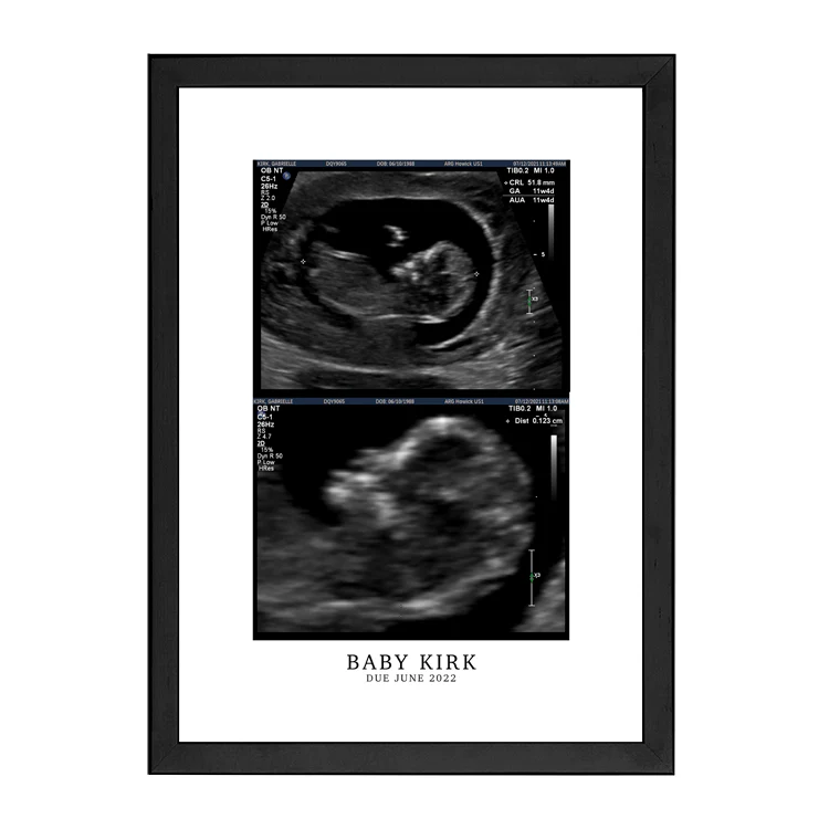 CUSTOM BIRTH ANNOUNCEMENT PRINT - Image 8