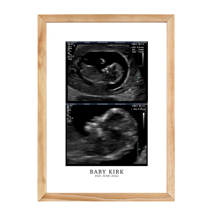 CUSTOM BIRTH ANNOUNCEMENT PRINT - Image 9